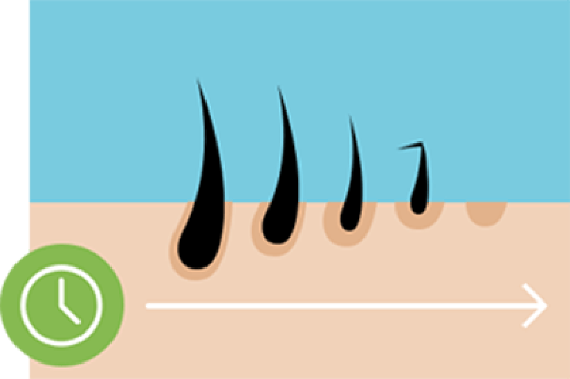 Cartoon of the hair growth cycle over time.