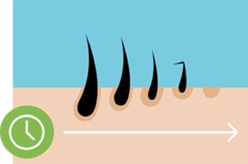 Cartoon of the hair growth cycle over time