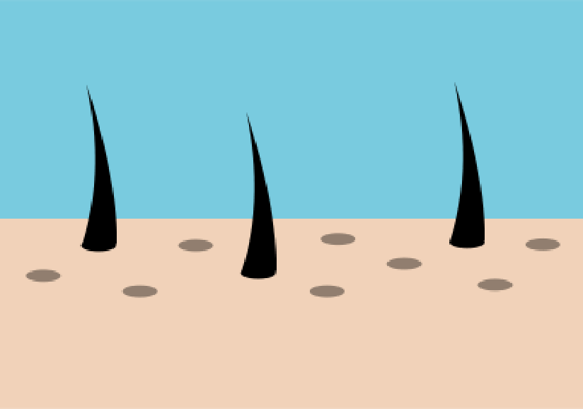 Cartoon image of empty hair follicles, demonstrating thinning hair